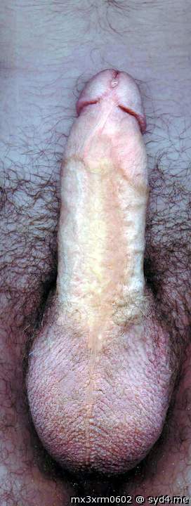 Photo of a third leg from mx3xrm0602