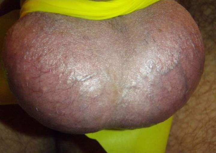 Testicles Photo from lilsoftee