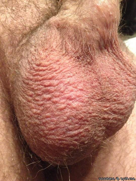 Testicles Photo from roccotano