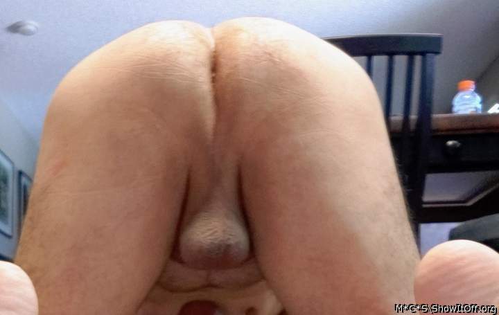 Photo of a short leg from M*C*S