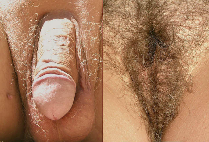 Photo of a prick from somna54