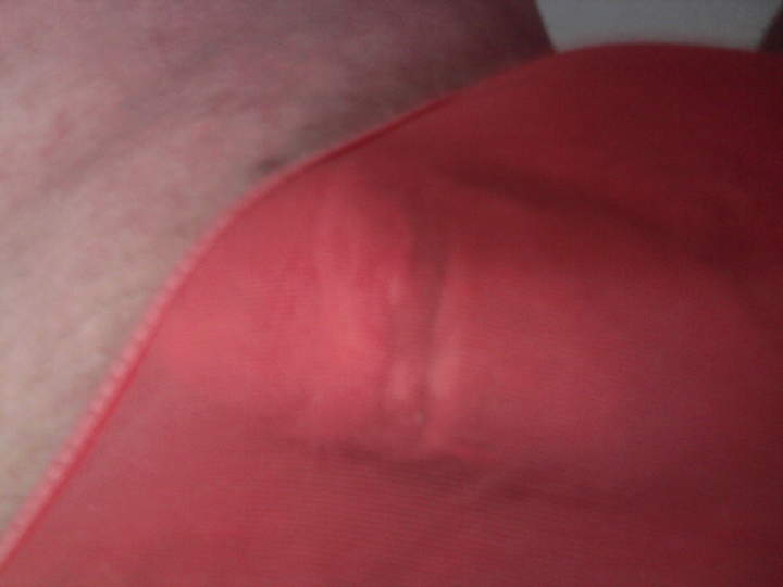 Photo of a middle leg from fronve