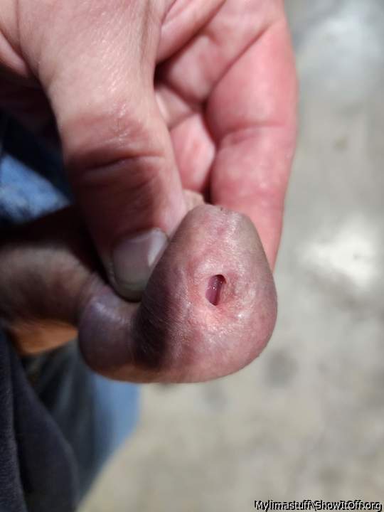 Pee hole