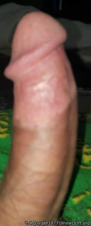 Photo of a prick from thatguygab1977