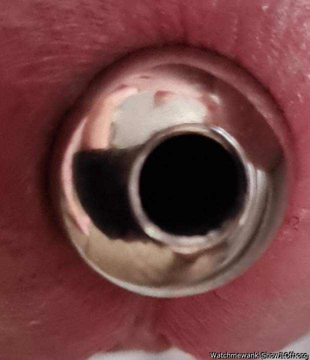 Urethra streched