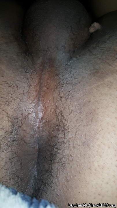 my asshole