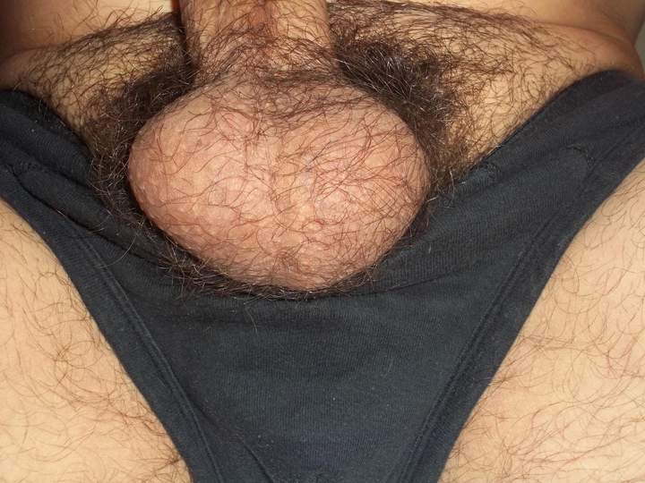 hairy little balls