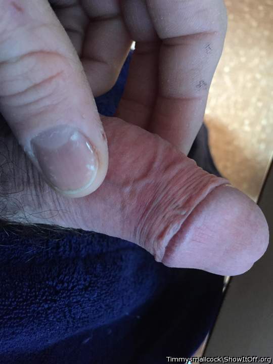 Photo of a middle leg from Timmysmallcock