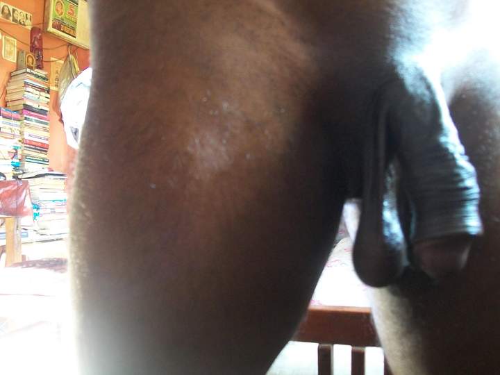 Photo of a third leg from 8darkchoco
