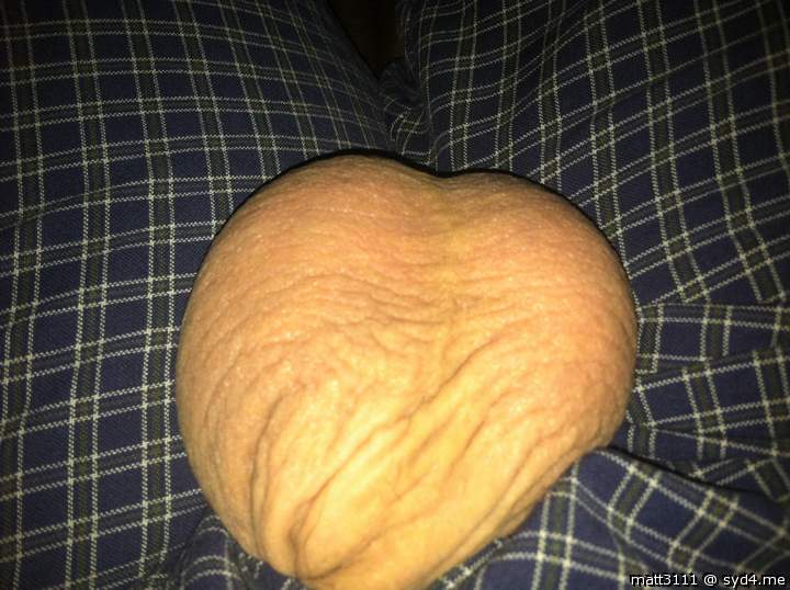 Testicles Photo from Matt3111