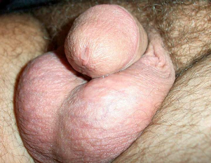 Photo of a wiener from lilsoftee
