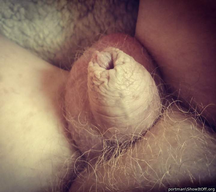 Foreskin
