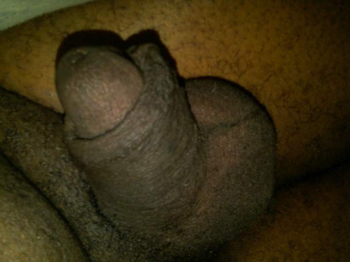 Photo of a middle leg from GaryMPLS72
