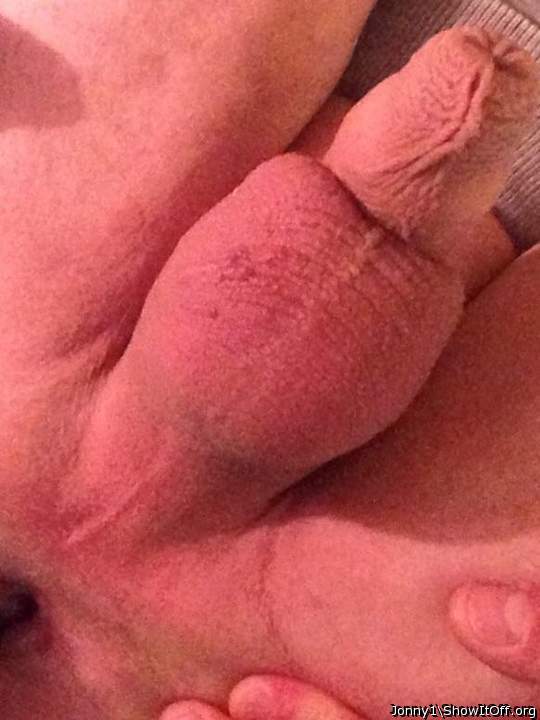 Photo of a middle leg from Jonny1