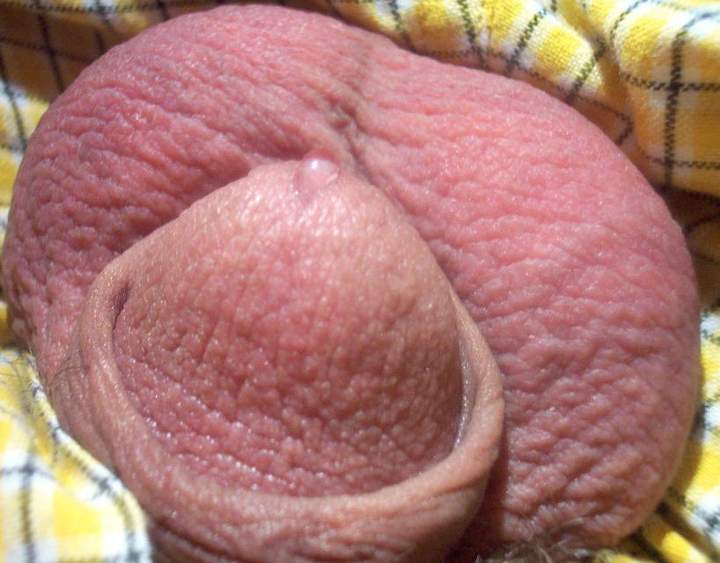 Testicles Photo from lilsoftee