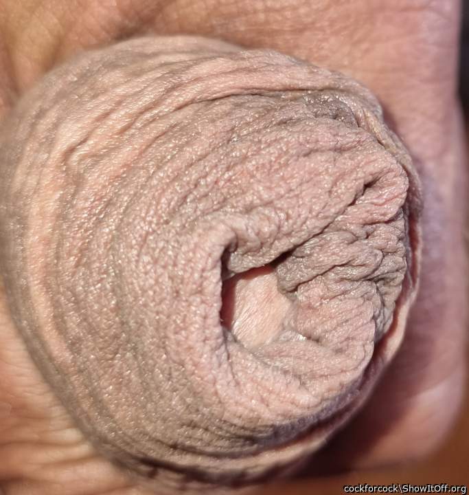 More than enough skin