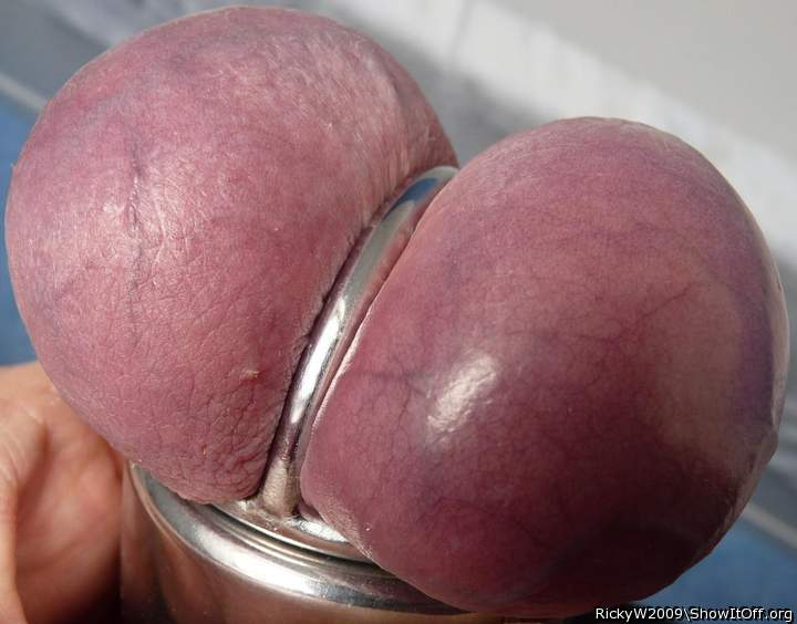 Tight scrotum