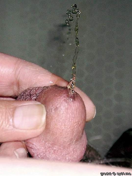 Photo of a penile from greatct