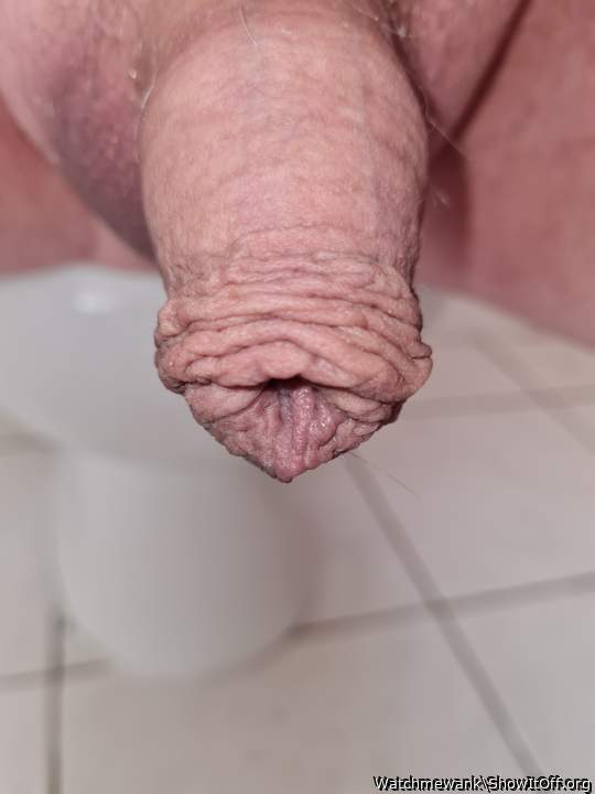 Foreskin 3