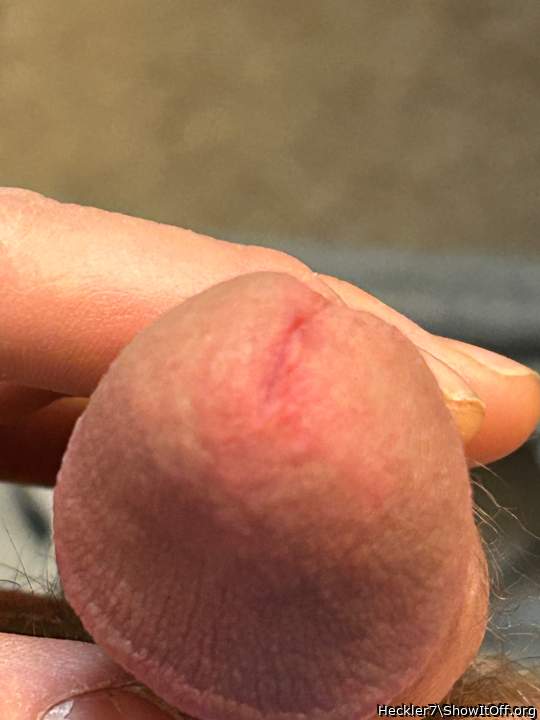 Photo of a penile from Heckler7