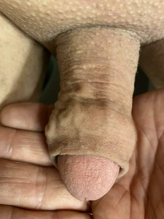 Photo of a penis from freaky