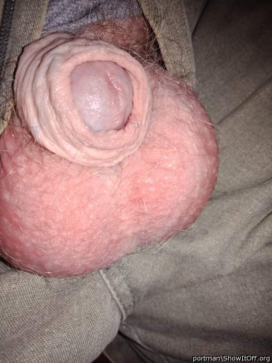 Your testicles are great, but don't forget the foreskin 