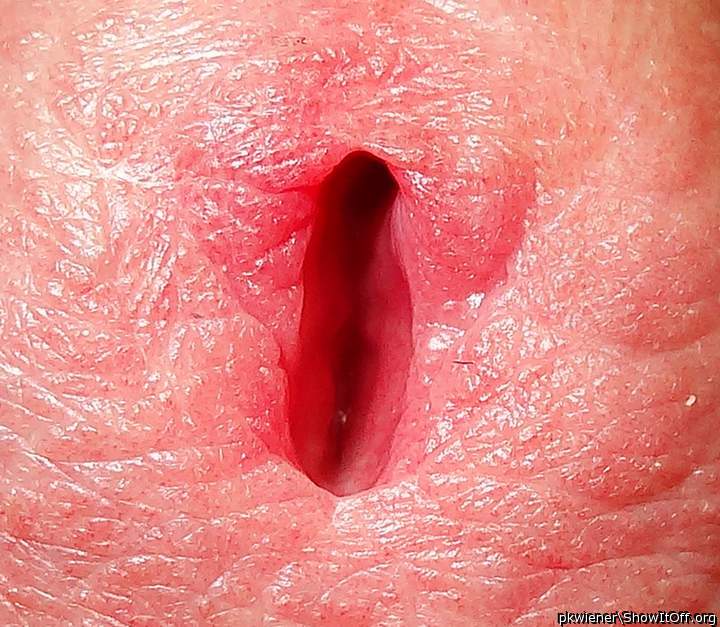 Extreme closeup