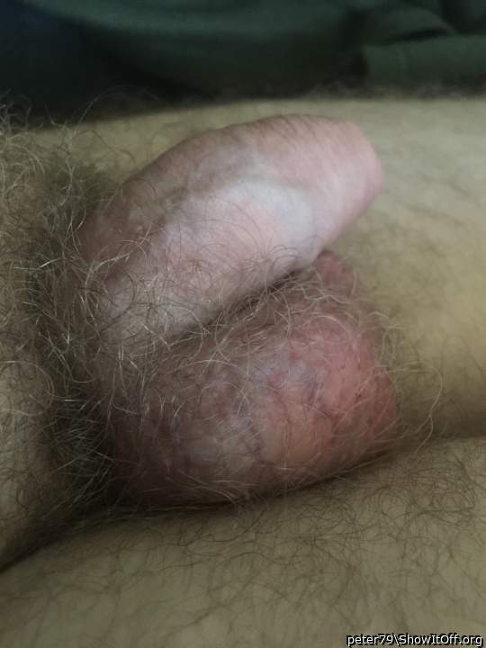 Photo of a short leg from peter79