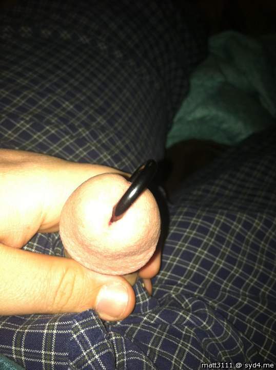 Photo of a prick from Matt3111