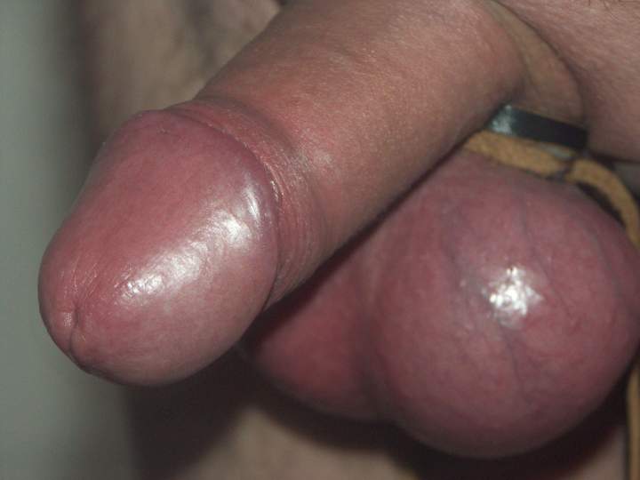 Photo of a schlong from man19