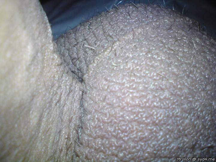 Testicles Photo from Mrollon