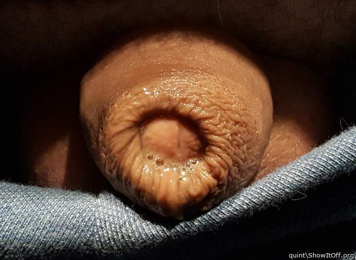 False or real foreskin??