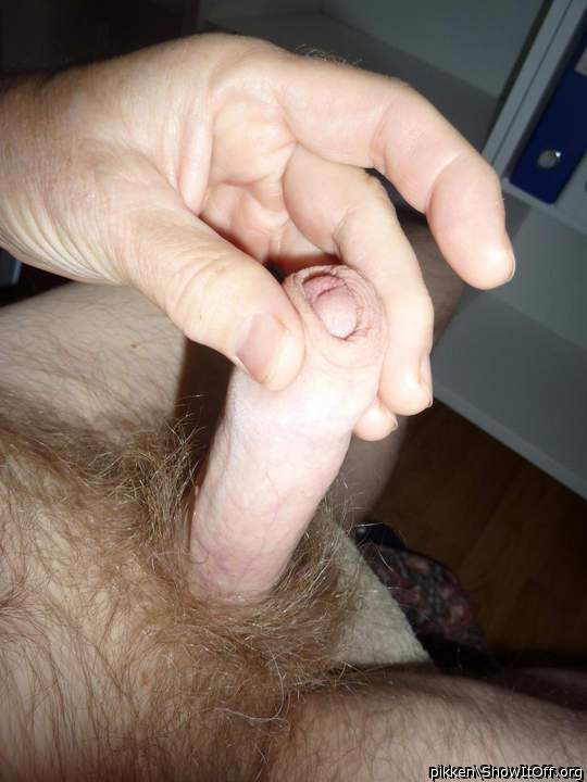 Nice to see your skin forward!     