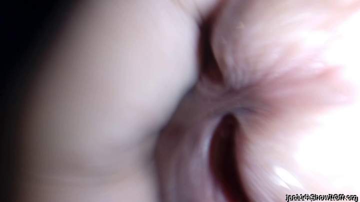 Photo of a middle leg from jac114