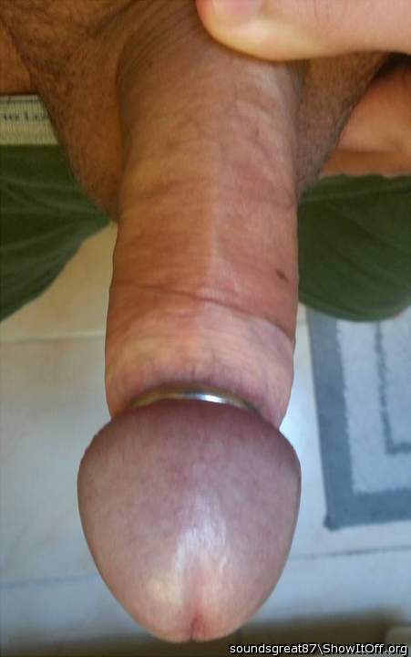Steel glans ring holds my foreskin back
