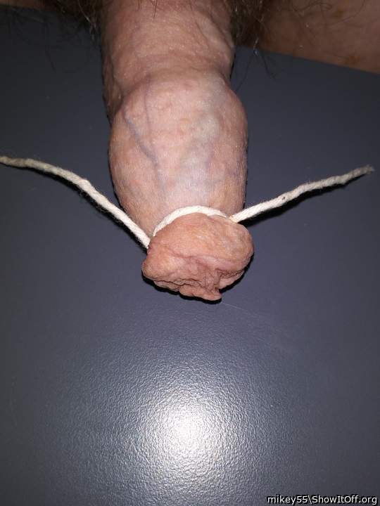 Foreskin tied