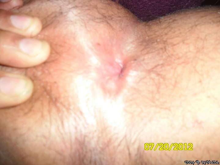Photo of a prick from choy