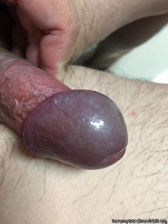 Gorgeous swollen glans!!  