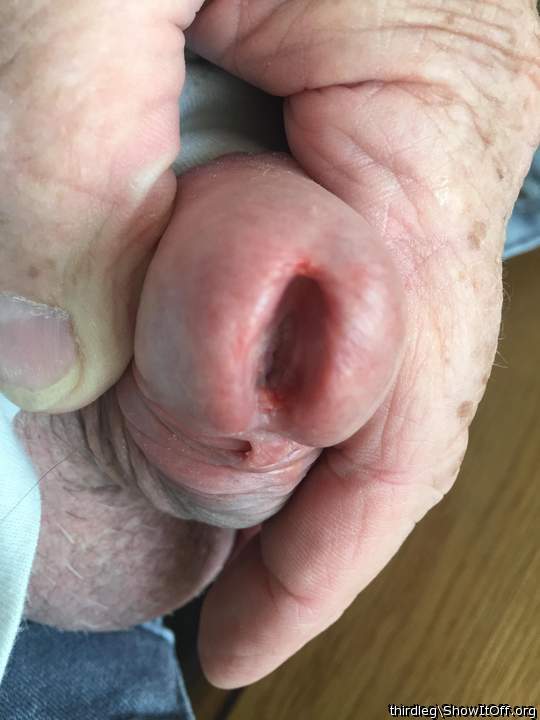 Split