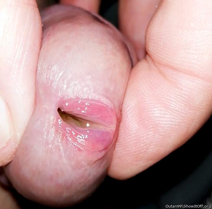 pee hole