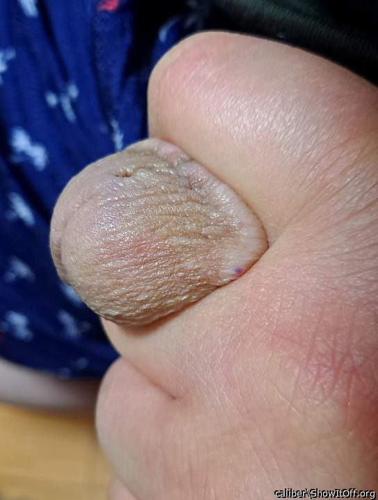 Photo of a penile from caliber