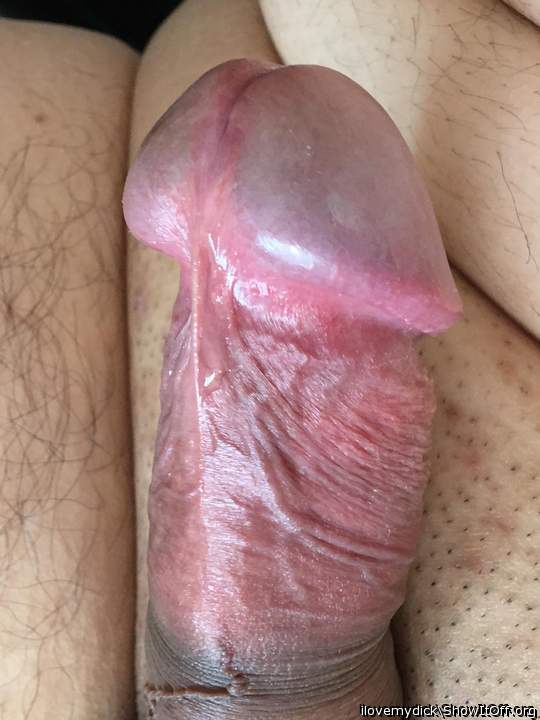 Photo of a penile from ilovemydick
