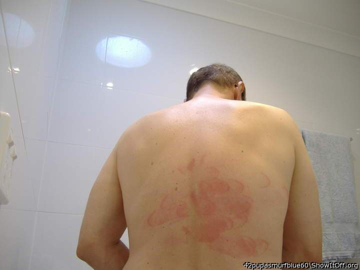 Red back