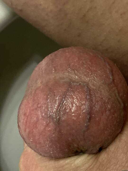 Testicles Photo from freaky