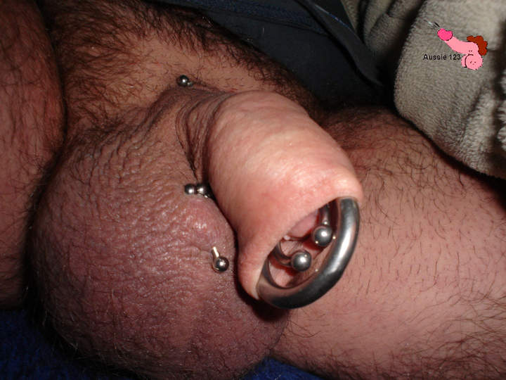 Photo of a short leg from Aussie123