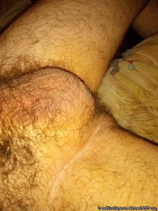 Testicles Photo from DeadEndSperm