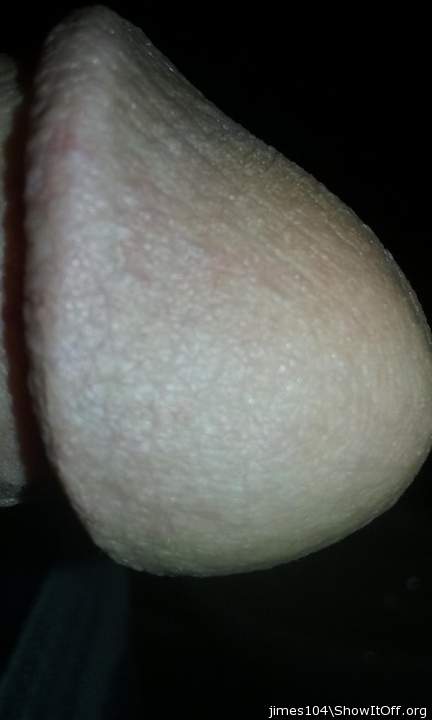 Photo of a prick from jimes104