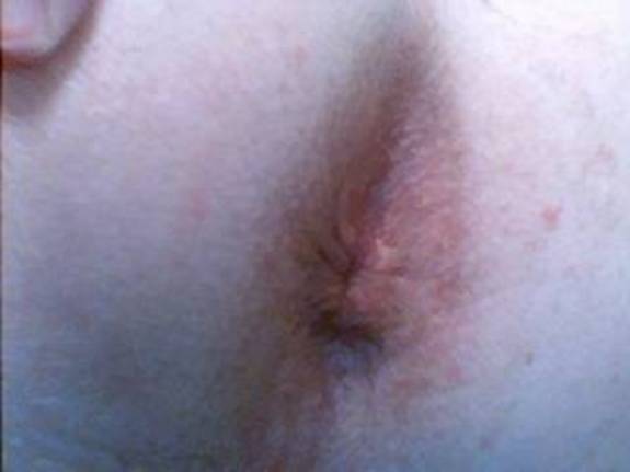 Photo of Man's Ass from countlodoss