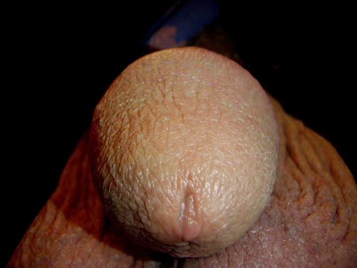 Photo of a bald-headed mouse from lilsoftee