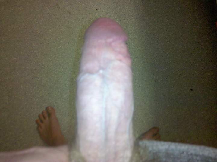 Photo of a horn from skinb